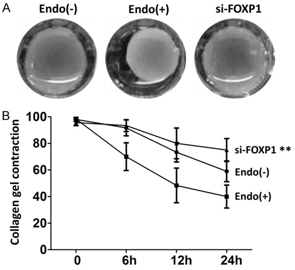 FOXP1 enhances fibrosis via activating Wnt/β-catenin signaling pathway in endometriosis.